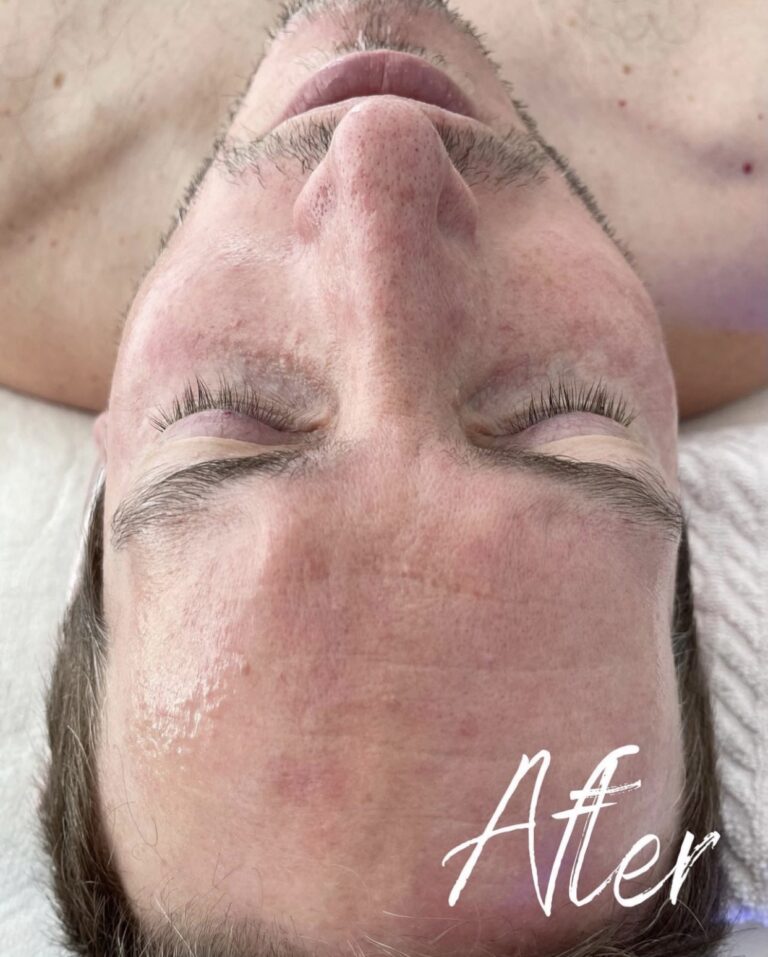 HydraFacial Toronto, Toronto HydraFacial, HydraFacial Near Me, Best HydraFacial Toronto, Luxury Facial Toronto, Facial Treatment Toronto, Glowing Skin Toronto, Radiance Facial Toronto, Age Rewind Facial, Hydrating Facial Toronto, Deep Cleansing Facial, Medical Facial Toronto, Anti Aging Facial Toronto, Skincare Toronto, Facial Spa Toronto, Spa Toronto, Toronto Wellness Spa, Luxury Spa Toronto, Body Sculpt Massage Toronto, Lymphatic Massage Toronto, Lymphatic Drainage Massage Toronto, Body Contouring Toronto, Sculpting Massage Toronto, Reduce Bloating Toronto, Water Retention Treatment Toronto, Detox Massage Toronto, Wellness Massage Toronto, Skin Rejuvenation Toronto, Brightening Facial Toronto, Pore Cleansing Facial Toronto, Healthy Skin Toronto, Facial Clinic Toronto, Beauty Spa Toronto, Skin Hydration Toronto, Toronto Aesthetic Spa, Skin Glow Treatment Toronto, Female Owned Business Toronto, Toronto Facial Specialist, Toronto Massage Spa, Non Invasive Body Sculpting Toronto, Kensington Market Spa, Downtown Toronto Facial, Toronto Self Care, Luxury Wellness Toronto, Radiant Skin Toronto, Skin Renewal Toronto, Custom Facial Toronto, Facial Boutique Toronto, Premium Spa Toronto.