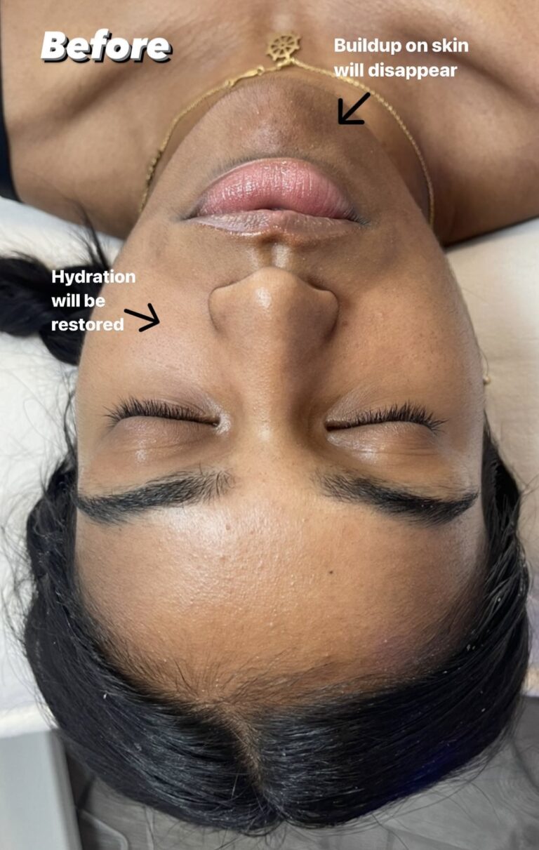 HydraFacial Toronto, Toronto HydraFacial, HydraFacial Near Me, Best HydraFacial Toronto, Luxury Facial Toronto, Facial Treatment Toronto, Glowing Skin Toronto, Radiance Facial Toronto, Age Rewind Facial, Hydrating Facial Toronto, Deep Cleansing Facial, Medical Facial Toronto, Anti Aging Facial Toronto, Skincare Toronto, Facial Spa Toronto, Spa Toronto, Toronto Wellness Spa, Luxury Spa Toronto, Body Sculpt Massage Toronto, Lymphatic Massage Toronto, Lymphatic Drainage Massage Toronto, Body Contouring Toronto, Sculpting Massage Toronto, Reduce Bloating Toronto, Water Retention Treatment Toronto, Detox Massage Toronto, Wellness Massage Toronto, Skin Rejuvenation Toronto, Brightening Facial Toronto, Pore Cleansing Facial Toronto, Healthy Skin Toronto, Facial Clinic Toronto, Beauty Spa Toronto, Skin Hydration Toronto, Toronto Aesthetic Spa, Skin Glow Treatment Toronto, Female Owned Business Toronto, Toronto Facial Specialist, Toronto Massage Spa, Non Invasive Body Sculpting Toronto, Kensington Market Spa, Downtown Toronto Facial, Toronto Self Care, Luxury Wellness Toronto, Radiant Skin Toronto, Skin Renewal Toronto, Custom Facial Toronto, Facial Boutique Toronto, Premium Spa Toronto.